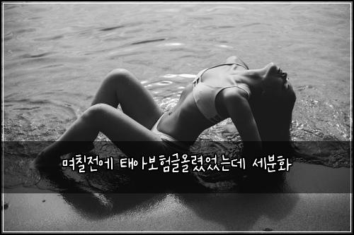며칠전에 태아보험글올렸었는데 세분화